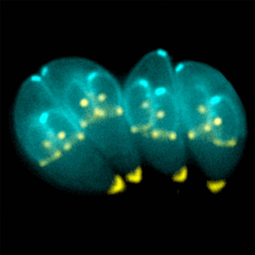toxoplasma-gondii_2025_1_JM